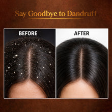Load image into Gallery viewer, Scalp &amp; hair mask |MUD SPA| (500ml) | Anti-Dandruff | Hairfall | Repair Damage | Dryness | Frizz-contro;
